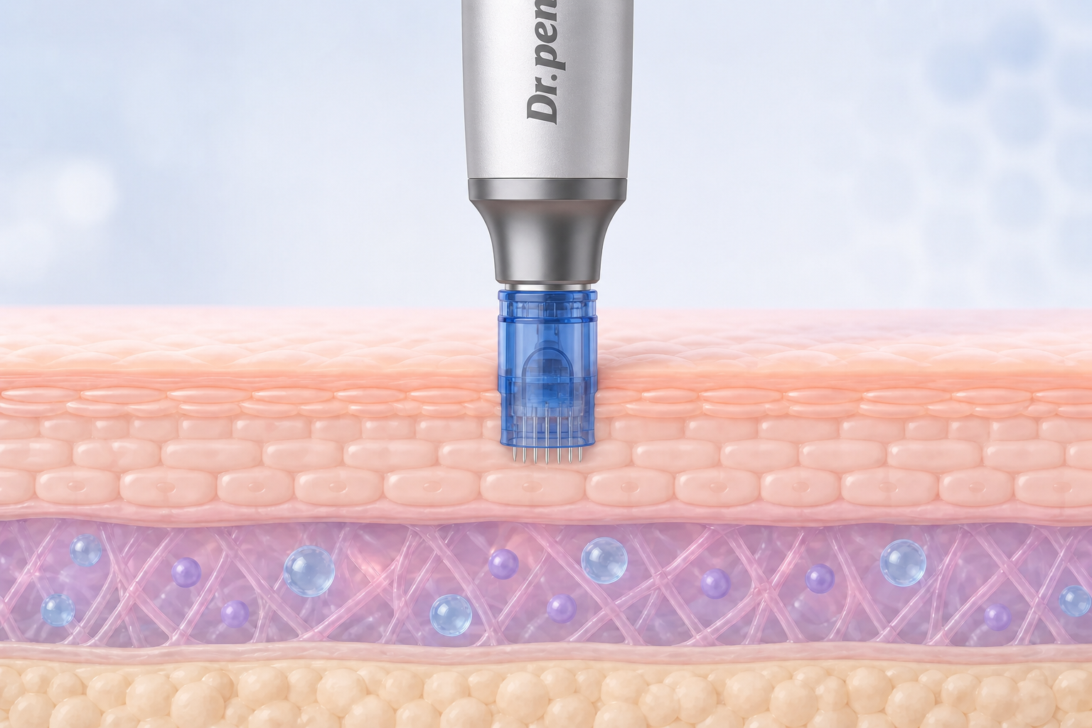 Nanoneedling for Sensitive Skin: A Gentle Guide for Beginners